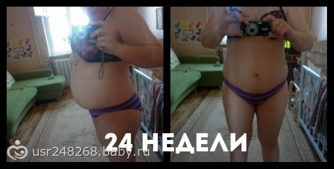 Если за беременность потолстели ноги Если за беременность потолстели ноги