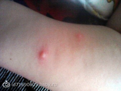 Как сделать губки попухлее Как сделать губки попухлее