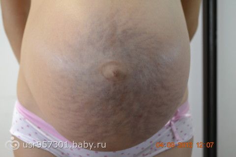 Как меньше есть при беременности