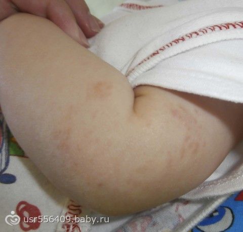 Может ли болеть зуб если удален нерв Зубы Макияж на Хэллоуин для девушек, детей и девочек в домашних условиях: Как