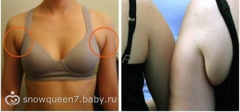 как убрать жир с подмышек за неделю как убрать жир с подмышек за неделю