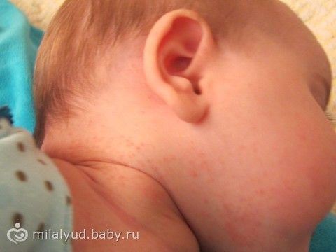 Как сделать костюм пирата своими руками? Как лечить простатит в домашних условиях, причины простатита