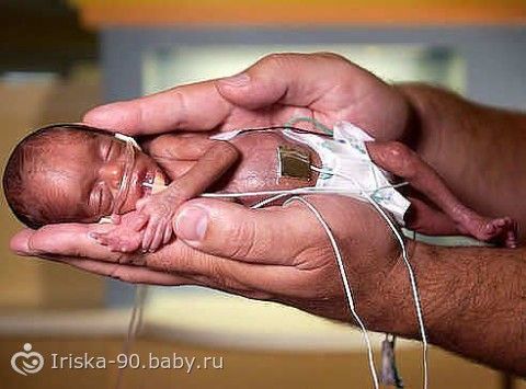 Как сделать выкидыш дома в 28 недель