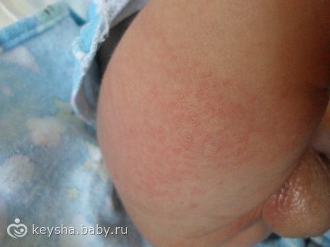 Как лечат зверей в зоопарке