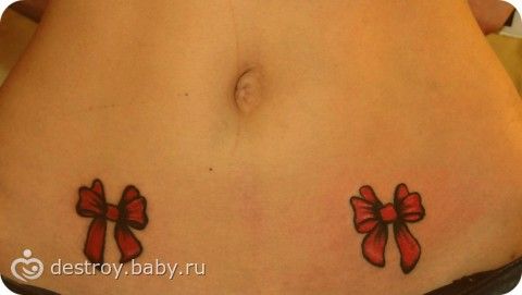 Что будет если сдирать корочку с тату
