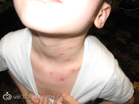 Связанные на природе женщины Связанные на природе женщины