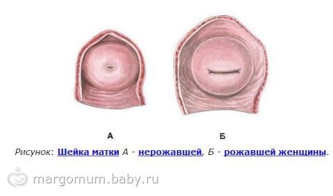 Почему увеличена матка если не беременна 31