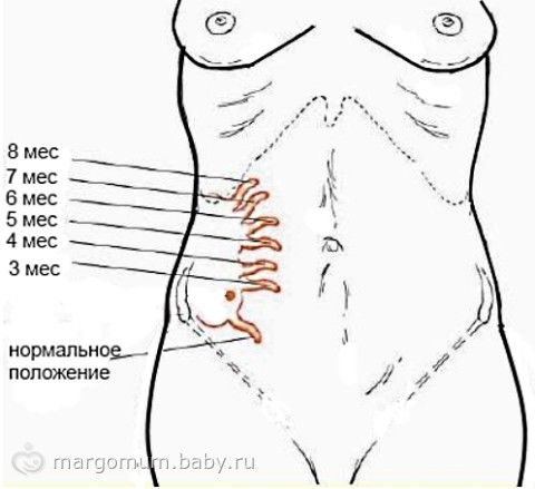 Как самой определить аппендицит - Naturapura.ru