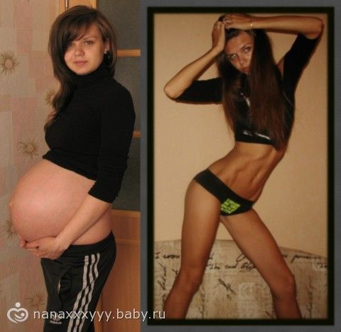 Можно ли с помощью спорта избавиться от целлюлита