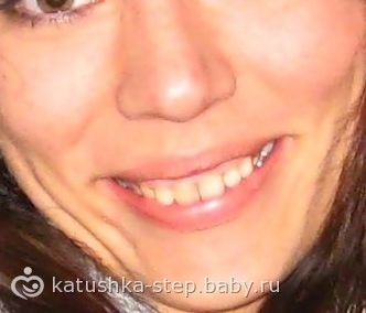 поставила коронки появился запах изо рта поставила коронки появился запах изо рта