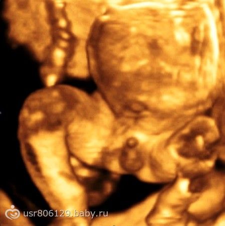 Фото узи беременных 20 недель