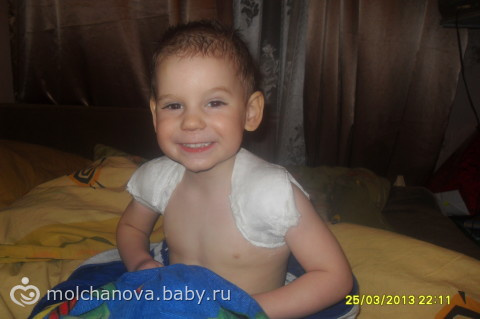 Сынуля даже в гипсе не перестает улыбаться))))