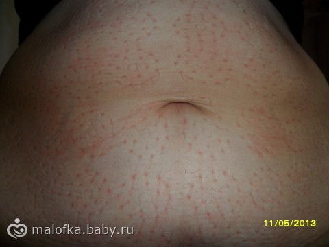 Средства и рецепты для похудения и борьбы с целлюлитом, которыми пользовалась я. Часть 3