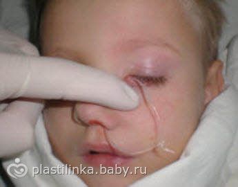 Электрофорез магнитотерапия физиолечение при эндометриозе