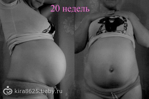 Через неделю 21. Живот на 20 неделе беременности двойней. Животы беременных двойней 20 недель.