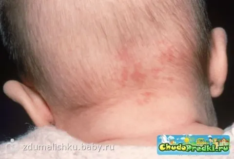Как из жестких волос сделать мягкими 7 Как из жестких волос сделать мягкими 50