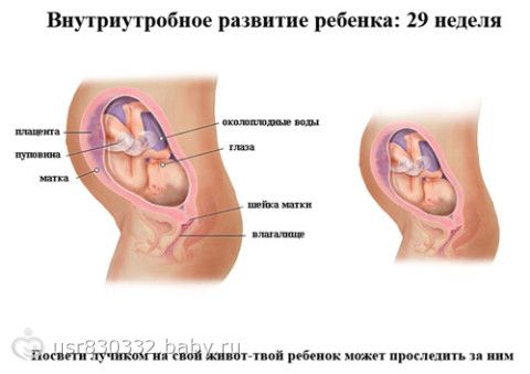 38 неделя беременности геморрой
