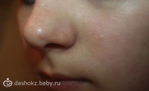 Маски для лица - избавляемся от жирного блеска и черных точек, а так же от сальных пробок