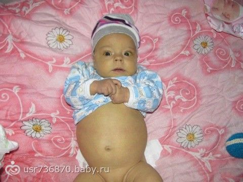 СБОР ЗАКРЫТ!!! ВОРОБЕЙ ДАНИЛ 4 месяца срочный сбор на пересадку печени!