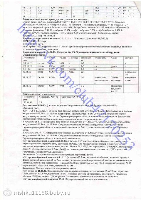 Виктория Кувайская 4 месяца. Синдром Крузона. СБОР ЗАКРЫТ.