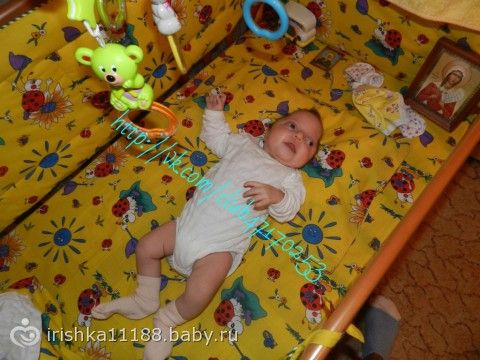Виктория Кувайская 4 месяца. Синдром Крузона. СБОР ЗАКРЫТ.