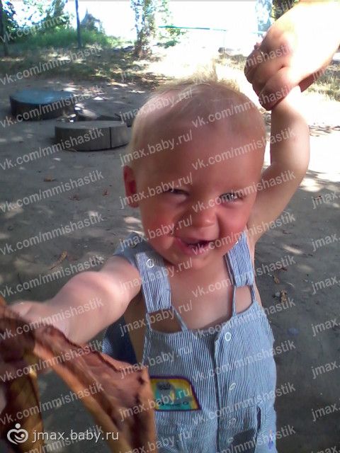 СБОР ОТКРЫТ. МИШУТКА МАХОВ, 1,9ГОДА: ПЕРВИЧНОЕ ИММУНОДЕФИЦИТНОЕ СОСТОЯНИЕ, ДЕФЕКТ ФАГАЦИТОЗА: ХРОНИЧЕСКАЯ ГРАНУЛЕМАТОЗНАЯ БОЛЕЗНЬ 1:1 000 000