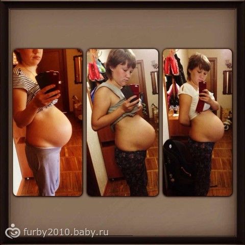 Опустился Живот Фото До И После